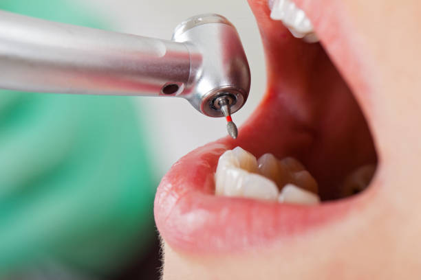Best Emergency Dentist for Knocked-Out Tooth in Plains, KS